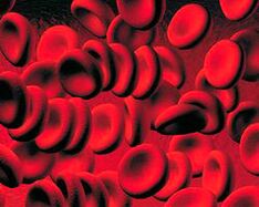 Accumulation of chatonic bodies in the blood in diabetes